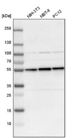 DLST Antibody, Novus Biologicals 0.1mL; Unlabeled:Antibodies, Polyclonal