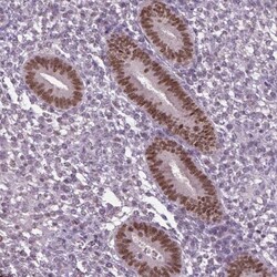 DLX5 Antibody, Novus Biologicals 0.1mL; Unlabeled:Antibodies, Polyclonal