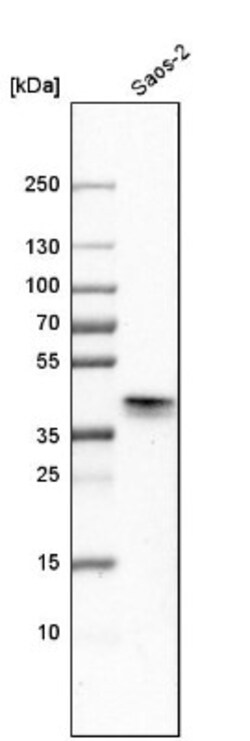 DLX5 Antibody, Novus Biologicals 0.1mL; Unlabeled:Antibodies, Polyclonal