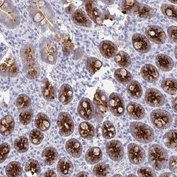 DMBT1/GP340 Antibody, Novus Biologicals 0.1mL; Unlabeled:Antibodies, Polyclonal