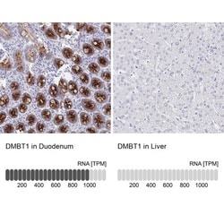 DMBT1/GP340 Antibody, Novus Biologicals 0.1mL; Unlabeled:Antibodies, Polyclonal
