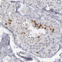 DMC1 Antibody, Novus Biologicals:Antibodies:Primary Antibodies