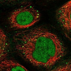 DMP-1 Antibody, Novus Biologicals 25 &mu;L | Buy Online | Novus Biologicals | Fisher Scientific