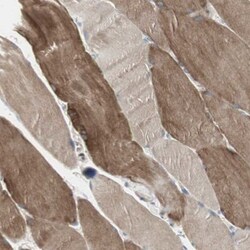 DMPK Antibody, Novus Biologicals:Antibodies:Primary Antibodies