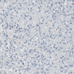DMPK Antibody, Novus Biologicals:Antibodies:Primary Antibodies