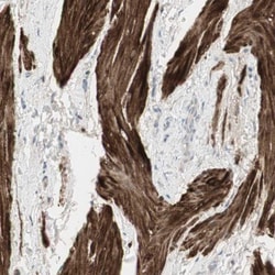 DMPK Antibody, Novus Biologicals:Antibodies:Primary Antibodies
