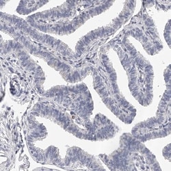 DMRT1 Antibody, Novus Biologicals:Antibodies:Primary Antibodies