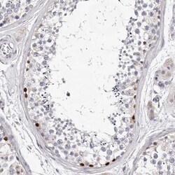 DMRT1 Antibody, Novus Biologicals:Antibodies:Primary Antibodies