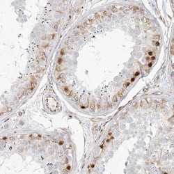 DMRTB1 Antibody, Novus Biologicals 25 &mu;L; Unlabeled:Antibodies, Polyclonal