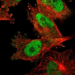 anti-DNA Ligase III, Polyclonal, Novus Biologicals 0.1mL; Unlabeled:Antibodies,