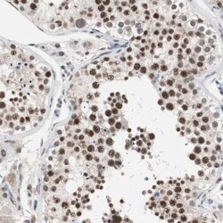 anti-DNA Ligase III, Polyclonal, Novus Biologicals 0.1mL; Unlabeled:Antibodies,