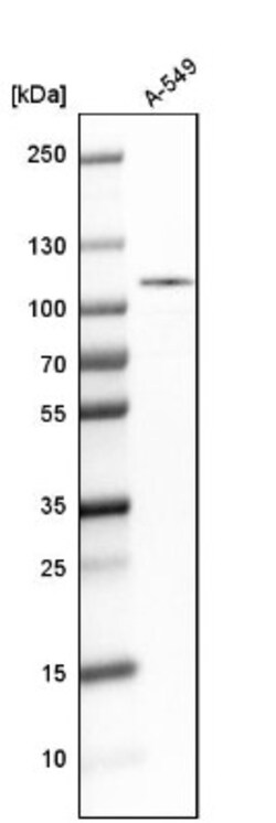 anti-DNA Ligase III, Polyclonal, Novus Biologicals 0.1mL; Unlabeled:Antibodies,