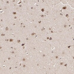 DNA Ligase IV Antibody, Novus Biologicals 0.1mL; Unlabeled:Antibodies,