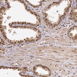DNA Ligase IV Antibody, Novus Biologicals 0.1mL; Unlabeled:Antibodies,