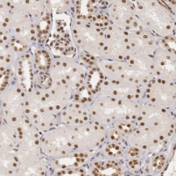 DNA Ligase IV Antibody, Novus Biologicals 0.1mL; Unlabeled:Antibodies,