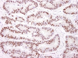 DNA-PKcs Antibody, Novus Biologicals 0.1mL; Unlabeled:Antibodies, Polyclonal