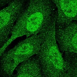 DNA Polymerase delta, catalytic subunit Antibody, Novus Biologicals 25