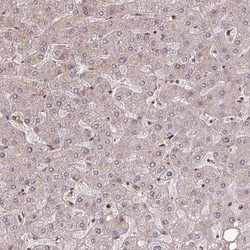 DNA Polymerase delta, catalytic subunit Antibody, Novus Biologicals 25