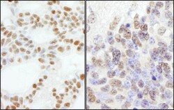 DNA Polymerase epsilon subunit 3 Antibody, Novus Biologicals 0.1mg; Unlabeled:Antibodies,