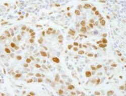 DNA Polymerase epsilon subunit 3 Antibody, Novus Biologicals 0.1mg; Unlabeled:Antibodies,