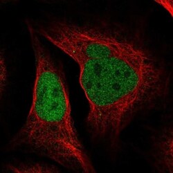 DNA polymerase delta p50 Antibody, Novus Biologicals 0.1mL; Unlabeled:Antibodies,