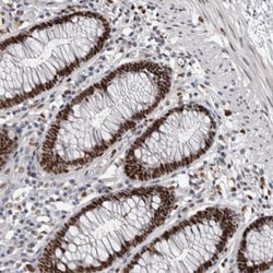 DNA polymerase delta p50 Antibody, Novus Biologicals 0.1mL; Unlabeled:Antibodies,