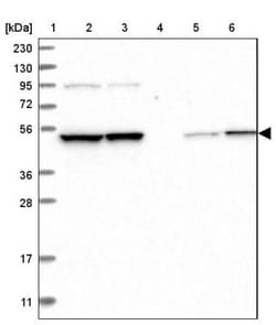 DNA polymerase delta p50 Antibody, Novus Biologicals 0.1mL; Unlabeled:Antibodies,