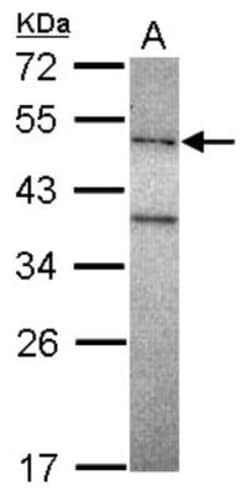 DNA polymerase mu Antibody, Novus Biologicals 0.1mL; Unlabeled:Antibodies,