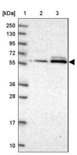 DNA polymerase sigma Antibody, Novus Biologicals 0.1mL; Unlabeled:Antibodies,