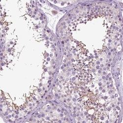 DNAH10 Antibody, Novus Biologicals 0.1mL; Unlabeled:Antibodies, Polyclonal