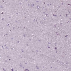 DNAH10 Antibody, Novus Biologicals 0.1mL; Unlabeled:Antibodies, Polyclonal