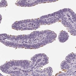 DNAH12 Antibody, Novus Biologicals 25 &mu;L, Unlabeled:Antibodies, Polyclonal