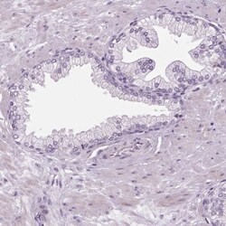DNAH12 Antibody, Novus Biologicals 25 &mu;L, Unlabeled:Antibodies, Polyclonal