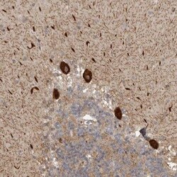 DNAH14 Antibody, Novus Biologicals 25 &mu;L; Unlabeled:Antibodies, Polyclonal