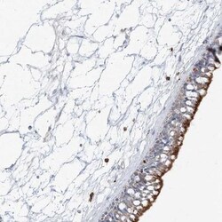 DNAH5 Antibody, Novus Biologicals:Antibodies:Primary Antibodies