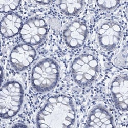 DNAI1 Antibody, Novus Biologicals 25 &mu;L | Buy Online | Novus Biologicals | Fisher Scientific