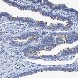 DNAI1 Antibody, Novus Biologicals 25 &mu;L | Buy Online | Novus Biologicals | Fisher Scientific