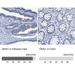 DNAI1 Antibody, Novus Biologicals 25 &mu;L | Buy Online | Novus Biologicals | Fisher Scientific