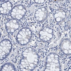 DNAI1 Antibody, Novus Biologicals 25 &mu;L; Unlabeled:Antibodies, Polyclonal