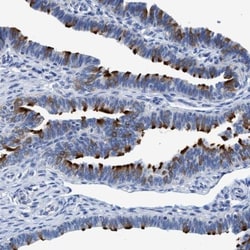 DNAI1 Antibody, Novus Biologicals 25 &mu;L; Unlabeled:Antibodies, Polyclonal
