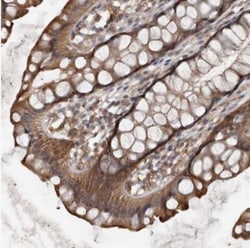DNAJB4 Antibody, Novus Biologicals 25 &mu;L; Unlabeled:Antibodies, Polyclonal