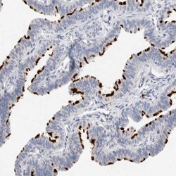 DNAJB6 Antibody, Novus Biologicals 0.1mL; Unlabeled:Antibodies, Polyclonal