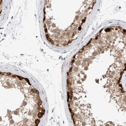 DNAJB6 Antibody, Novus Biologicals 0.1mL; Unlabeled:Antibodies, Polyclonal