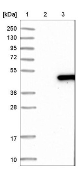 DNAJB6 Antibody, Novus Biologicals 0.1mL; Unlabeled:Antibodies, Polyclonal