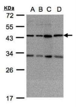 DNAJC17 Antibody, Novus Biologicals 0.1 mL | Buy Online | Novus Biologicals | Fisher Scientific