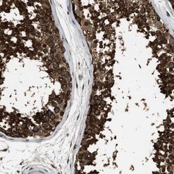 DNAJC2 Antibody, Novus Biologicals:Antibodies:Primary Antibodies