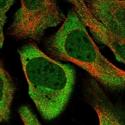 DNAJC6 Antibody, Novus Biologicals 25 &mu;L; Unlabeled:Antibodies, Polyclonal