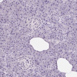 DNAJC6 Antibody, Novus Biologicals 25 &mu;L; Unlabeled:Antibodies, Polyclonal