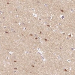 DNAJC6 Antibody, Novus Biologicals 25 &mu;L, Unlabeled:Antibodies, Polyclonal