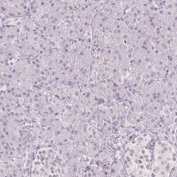 DNAJC6 Antibody, Novus Biologicals 25 &mu;L, Unlabeled:Antibodies, Polyclonal